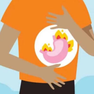 Low Stomach Acid Causes Heartburn (GERD), or Acid Reflux