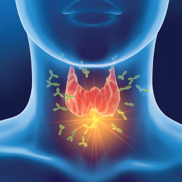 Efficacy of Natural Extracts in Treating Benign Thyroid Nodules