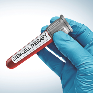 Stem Cell Therapy